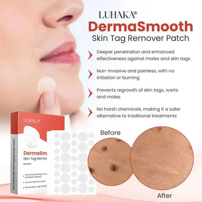 DermaSmooth Skin Tag Remover 72 Patch