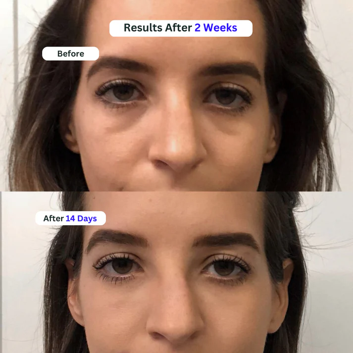 Under Eye Serum