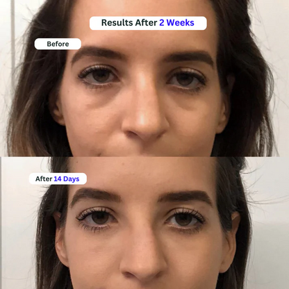 Under Eye Serum