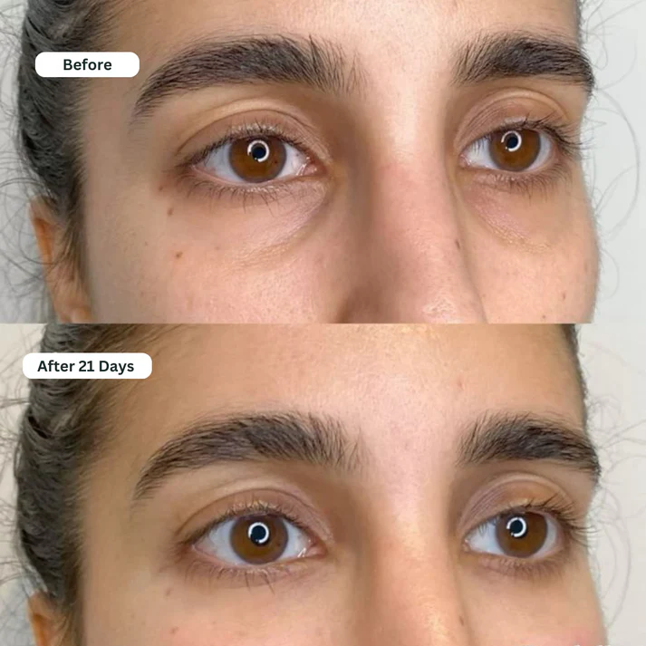 Under Eye Serum