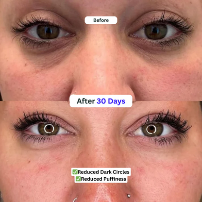 Under Eye Serum